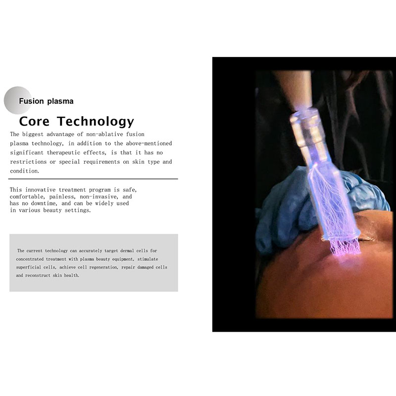 3 In 1 Cold Plasma Arc Fibroblast Skin Tightening Beauty Cold Clinic Plasma Therapy With Plasma 0zone Needleroller Purple Light