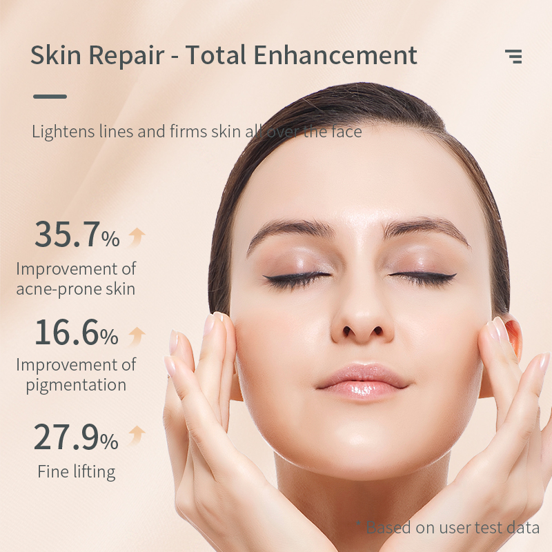 Wireless Plasma Lifting Skin Tightening Machine Acne Treatment Wrinkle Remover Beauty Machine Sterilization Feature Dark Circles