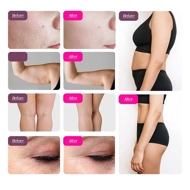80k Cavitation Machine Weight Loss Machine Fat Burning Instrument Body Shaping 80k Grease Explosion