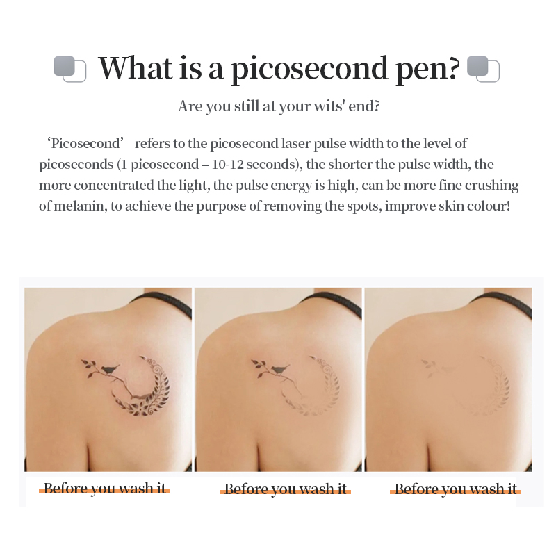 Home Handheld Beauty Picosecond Red Blue Picosecond Pen to Remove Melanin Spots and Moles Tattoo Removal Tool