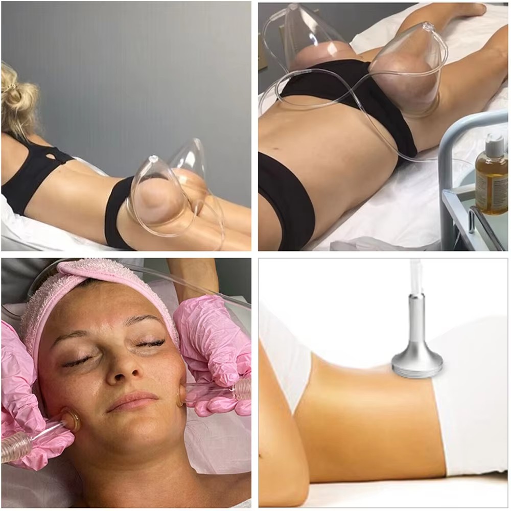 Colombian Suction Pump Buttocks Enlargement Cup Vacuum Therapy Butt Lift Enhancement Machine Breast Massager