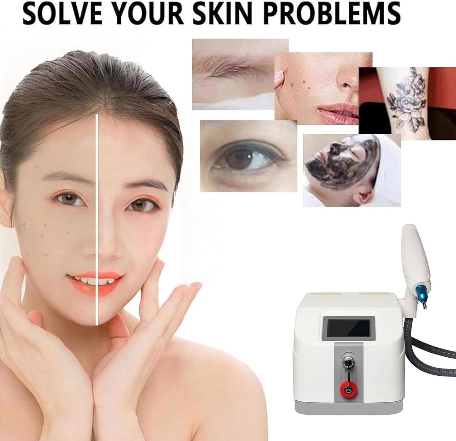 Laser Tattoo Removal Machine, Laser Remover for Tattoo Removal, Tattooed Skin Spots, Freckles, Laser Removal Device for Beauty Salons, Hospitals