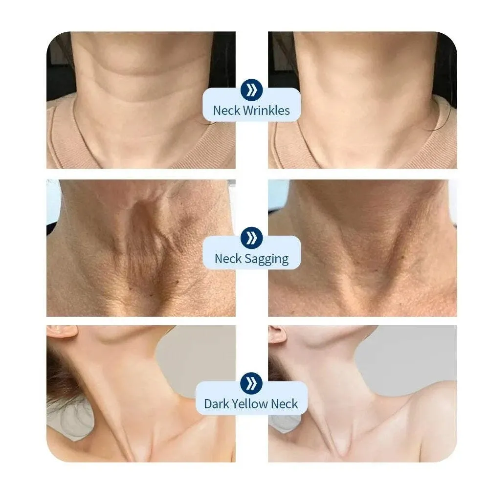 Anti-Wrinkle Skin Tightening Neck Beauty Device LED Photon Neck Lift Mask