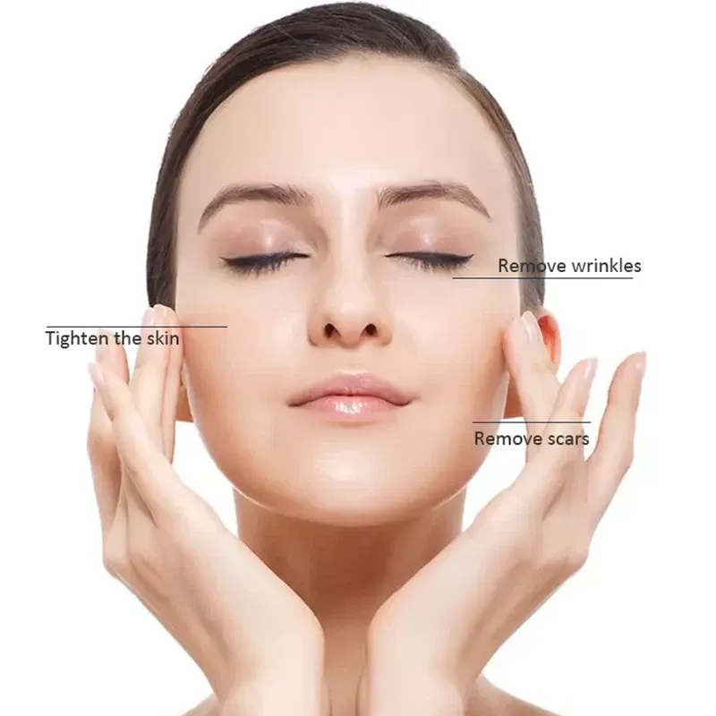 Fotona Co2 Fractional lase Treatment Machine 10600nm lase beaut machine For Resuacing Acne Scars 2025 Newest design 4D