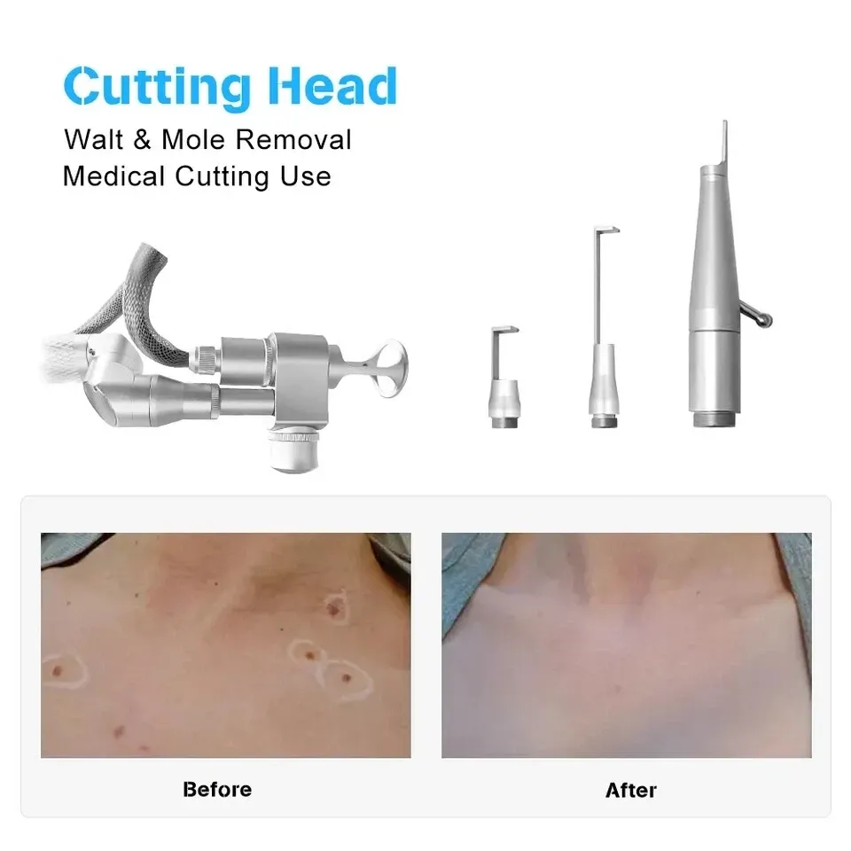 Fotona Co2 Fractional lase Treatment Machine 10600nm lase beaut machine For Resuacing Acne Scars 2025 Newest design 4D