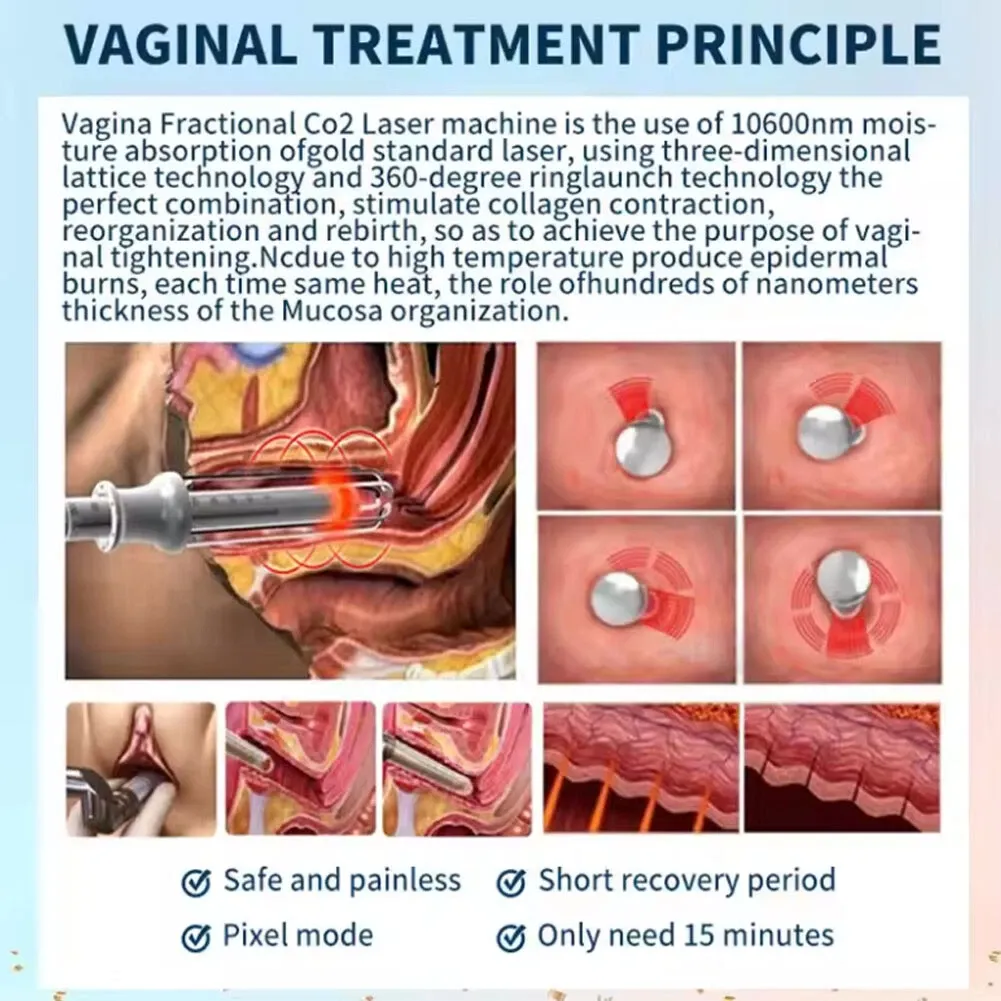 Portable Co2 fractional laser machine co2 laser cutting for vaginal tightening skin resurfacing smooth scar removal