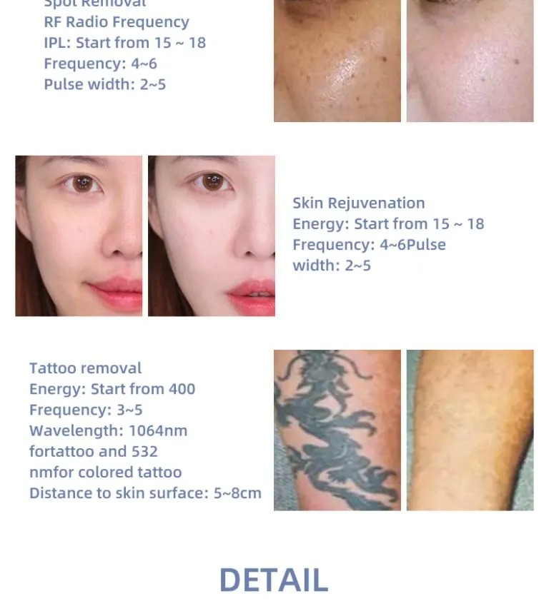 4 in 1 Tattoo Pigmentation Removal Beauty Machine IPL Hair Removal Salon Machine Skin Rejuvenation Acne Scar Removal Laser