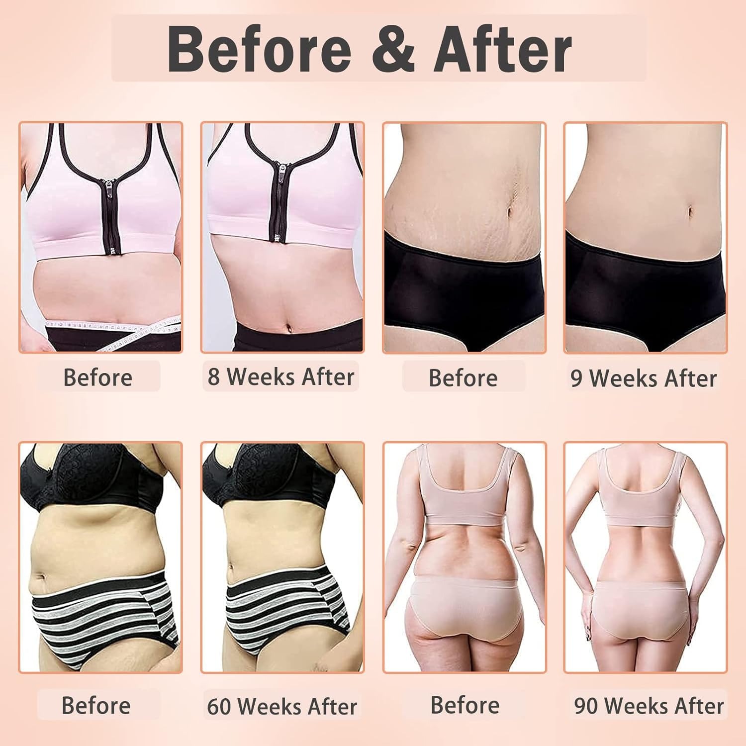6 in 1 Body Slimming & Sculpting Cavitation Machine Fat Burning & Skin Tightening
