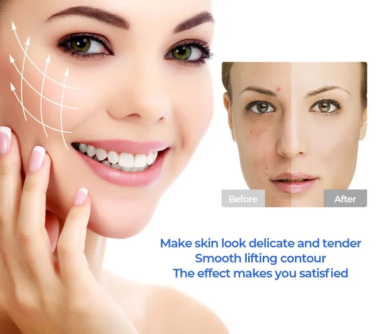 RF+Ultrasound Collagen Anti-aging Beauty Device - Face Lift, Skin Rejuvenation, Deep Cleaning