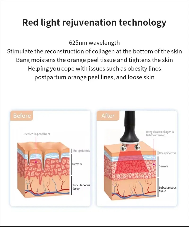 Roller Beauty Device Slimming IPL Home Roller Slimming Massage Modelling Fat Burst Beauty Device
