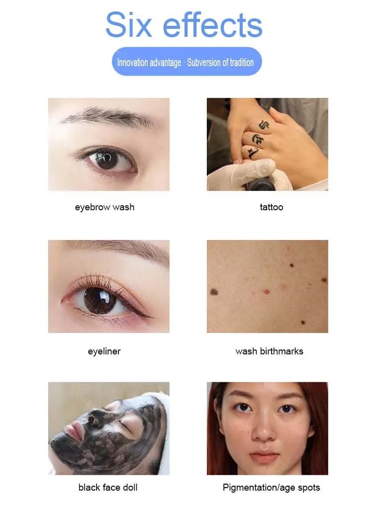 Portable Nd Yag Picosecond Laser Acne Treatment Tattoo Pigment Freckle Removal Machine Pico Second Pico Laser Salon With 1064Nm 755Nm 532Nm