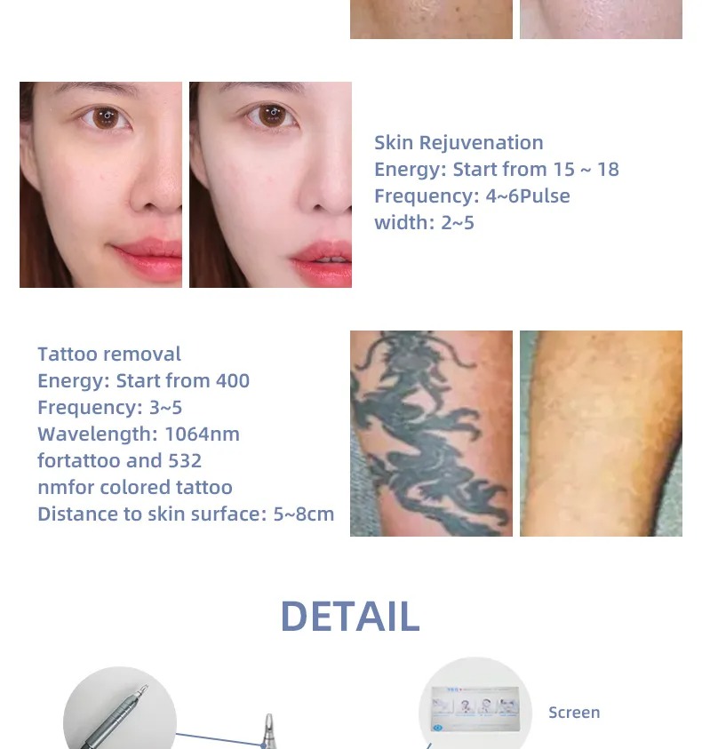 3-in-1 Beauty Device SHR Laser Hair Removal & Pico Tattoo Removal