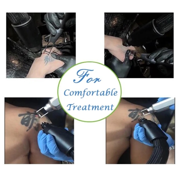 Advanced Skin Cooling Laser Tattoo Removal Machine - Comfortable, Low Noise, Effective Model for Professional Use
