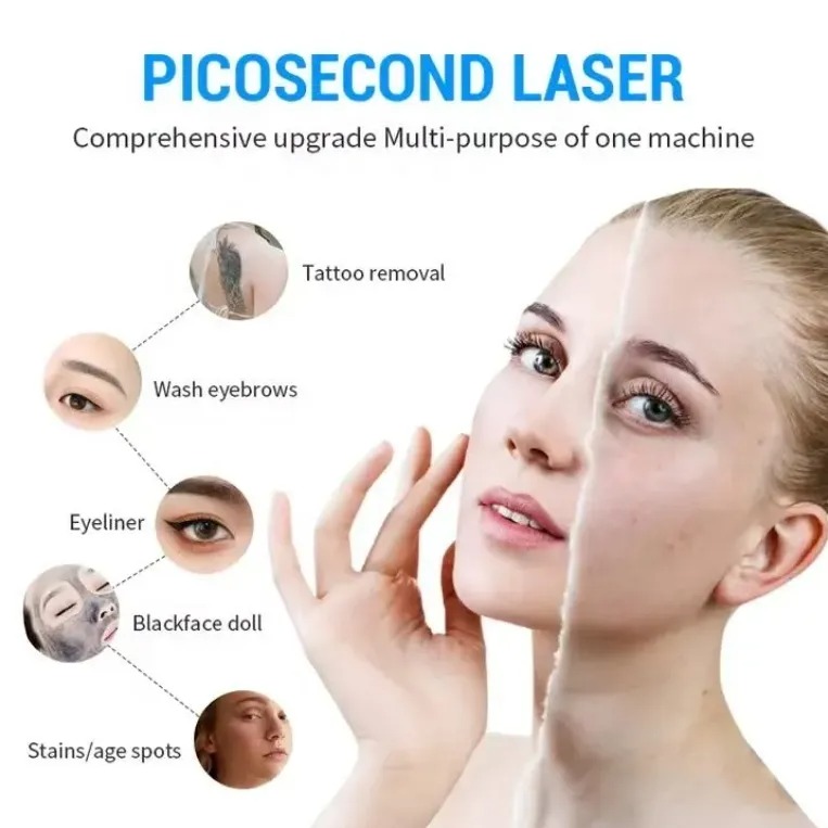 Advanced Laser System for Tattoo Removal and Skin Pigmentation Treatment