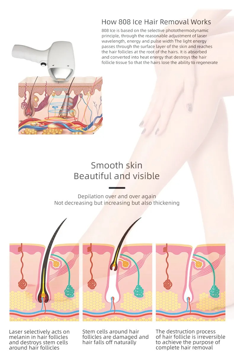 Tattoo Remove Machine 755nm 808nm 1064nm Epilation DiodeLaser Hair Removal Pico