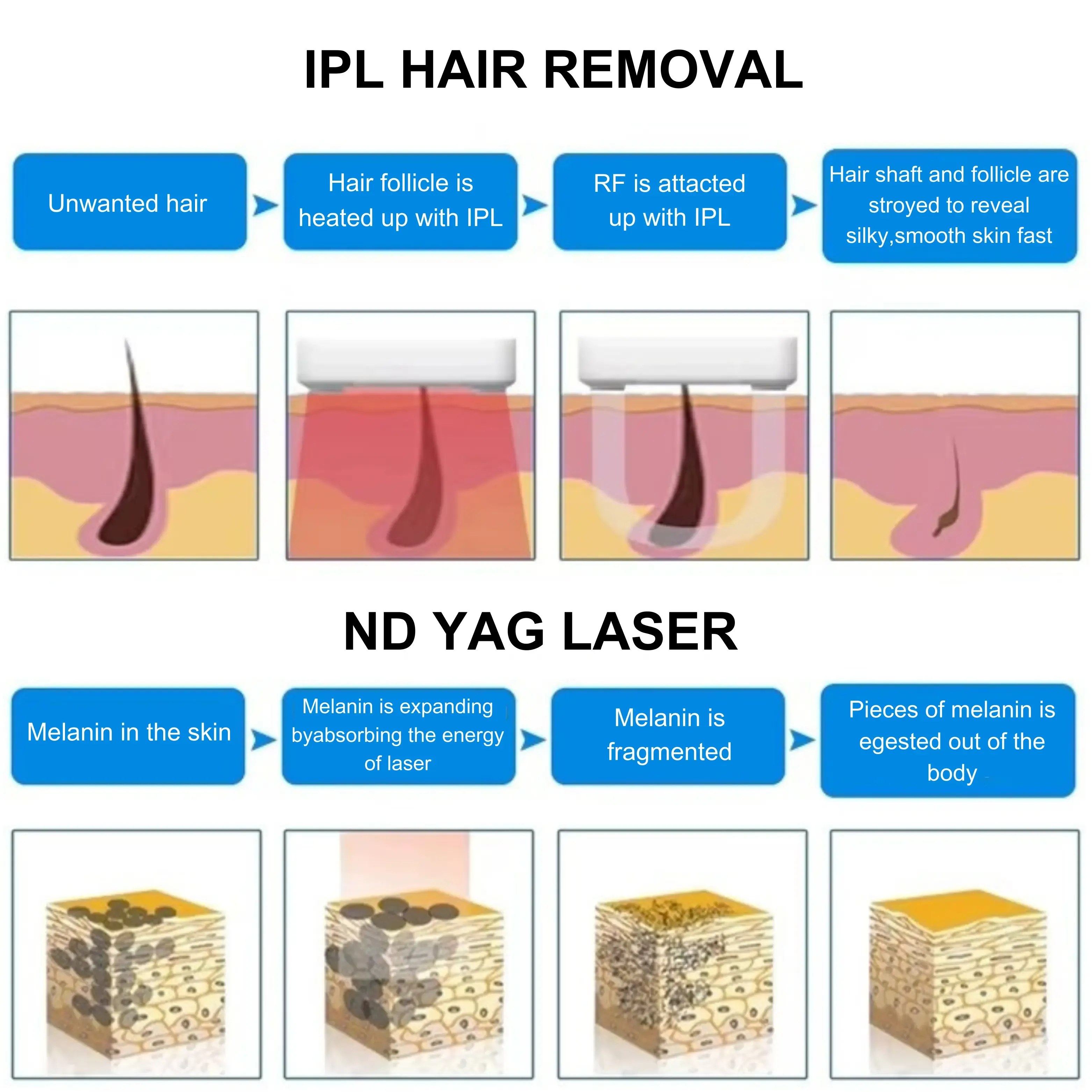 3-in-1 Laser Machine for Hair Removal + Tattoo Removal + E-Light Skin Rejuvenation