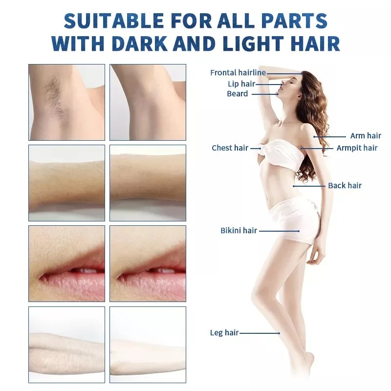 Portable Laser Hair Removal Device - Fast & Painless 808nm Diode Laser Epilator for Women & Men, Permanent Hair Reduction