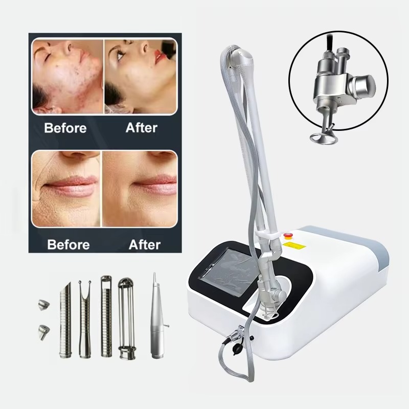 10600nm Rractional Co2 Laser Therapy Machine CO2 Fractional Laser Skin Machine