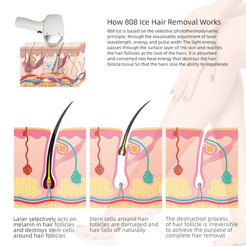 Tattoo Remove Machine 755nm 808nm 1064nm Epilation DiodeLaser Hair Removal Pico