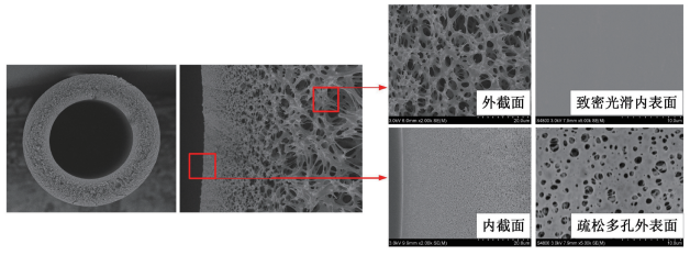 Polysulfone/polyethersulfone ultrafiltration membrane