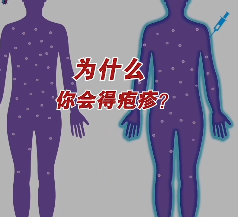 疱疹以及炎症的诱发_台湾媒体2021年对新冠疫苗副作用的专家解读【第6集】疱疹以及炎症的诱发COVID-19 vaccine injury_1zhish_Induction of herpes and inflammation