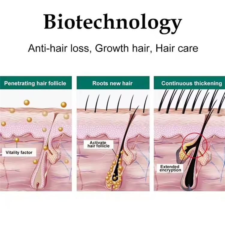 Hair growth serum polypeptide nicotinamide 100% pure natural plant extract, thick and strong hair