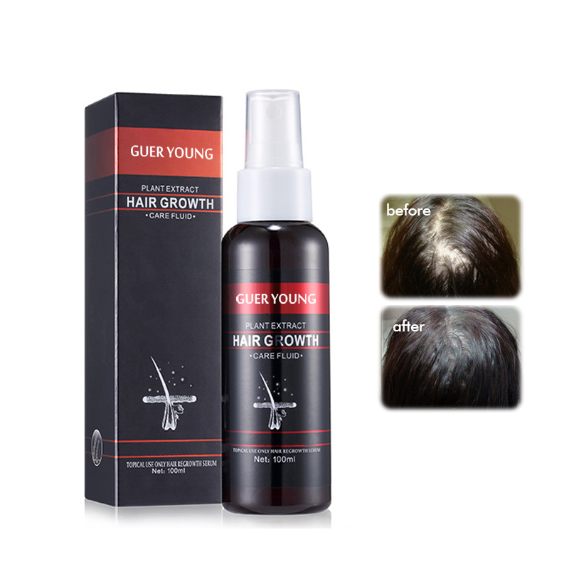 Plant Extract Hair Growth Care Fluid - 100ml Herbal Hair Regrowth Serum