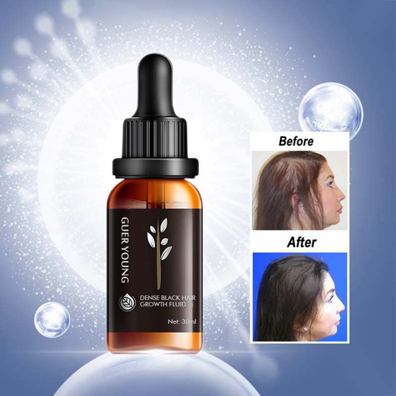 Dense Black Hair Growth Fluid - Herbal Essence Scalp Treatment for Hair Regrowth