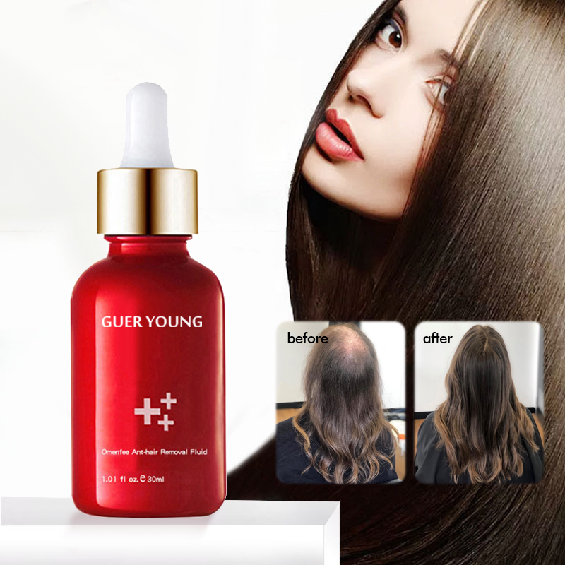Hair Revitalizing Serum – Red Bottle Anti-Hair Loss & Regrowth Essence 30ml