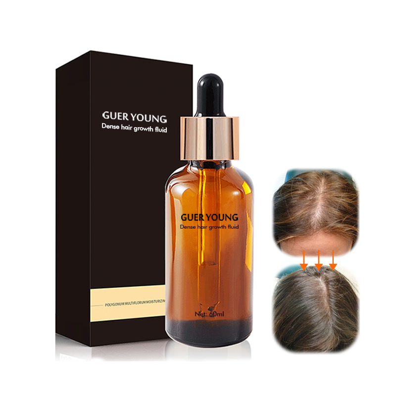 Herbal Hair Regrowth Essence – 60ml Natural Treatment for Thinning Hair & Scalp Nourishment
