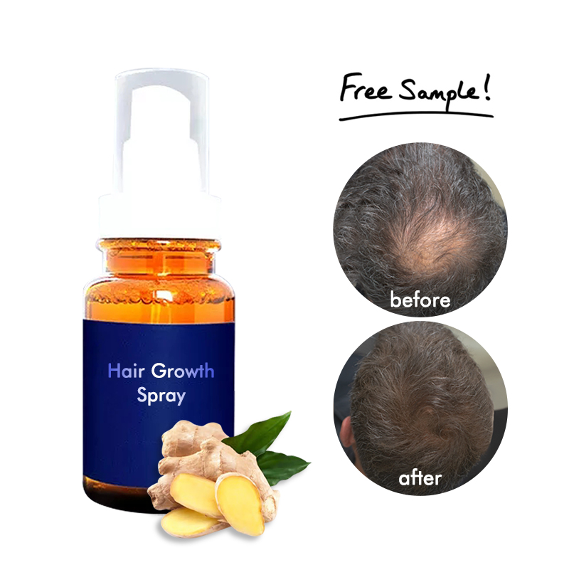 Hair Growth Spray – Herbal Anti-Hair Loss Serum for Fast Hair Regrowth & Scalp Nourishment