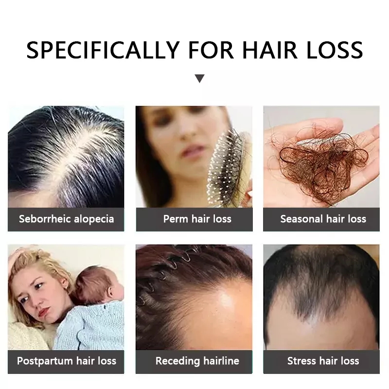 Hair Growth Spray – Herbal Anti-Hair Loss Serum for Fast Hair Regrowth & Scalp Nourishment