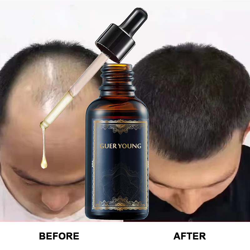 Intensive Hair Growth Serum – Anti Hair Loss & Scalp Nourishment Formula