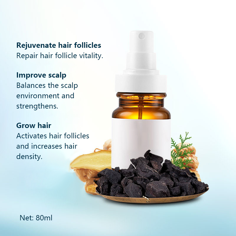 Natural Plant Hair Growth Serum – Anti Hair Loss Treatment for Thicker, Stronger Hair – 80ml