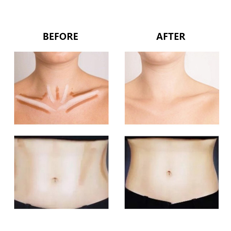 Full Coverage Concealer Stick for Flawless Skin