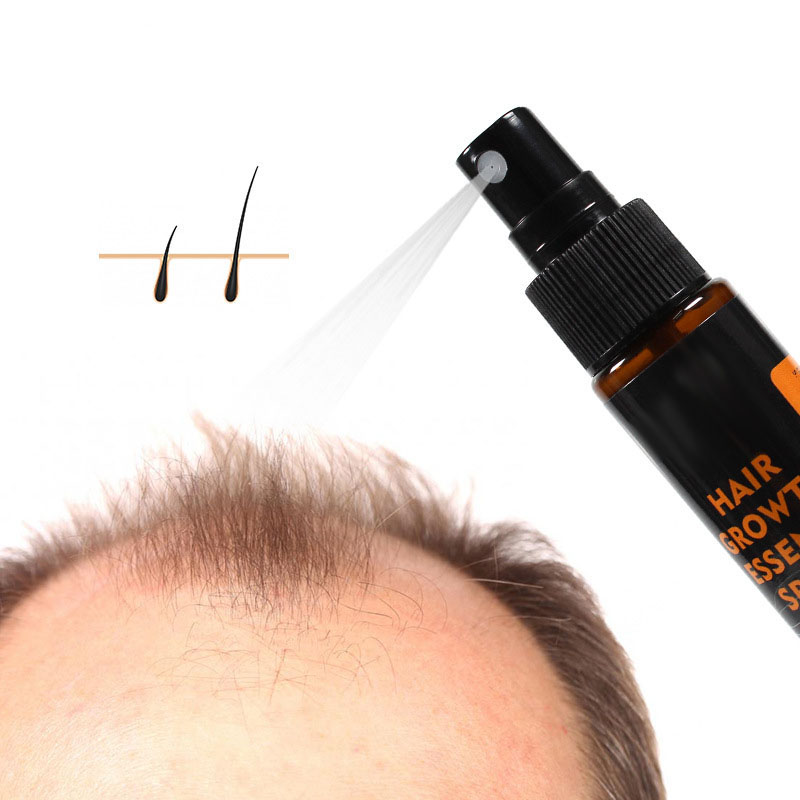 Hair Growth Essence Spray – Anti-Hair Loss & Beard Growth Treatment with Herbal Extracts – 30ml