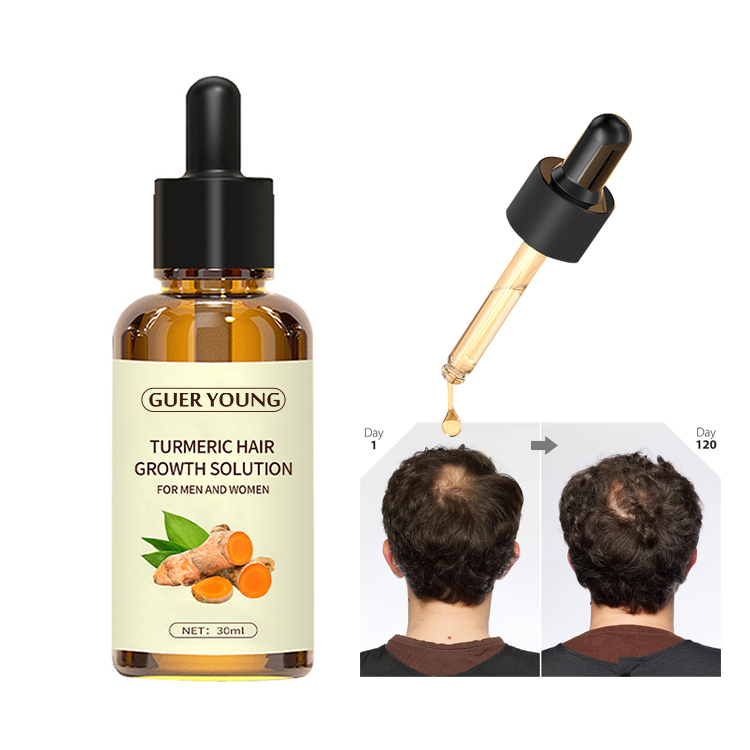 Turmeric Hair Growth Solution with Natural Plant Extracts for Men and Women