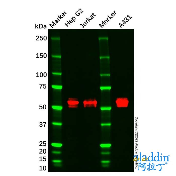 CaMKII Mouse mAb