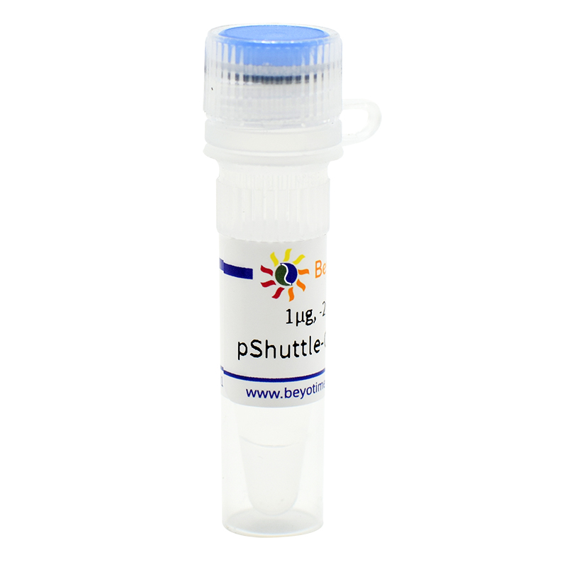 pShuttle-CMV-N-His(腺病毒质粒)