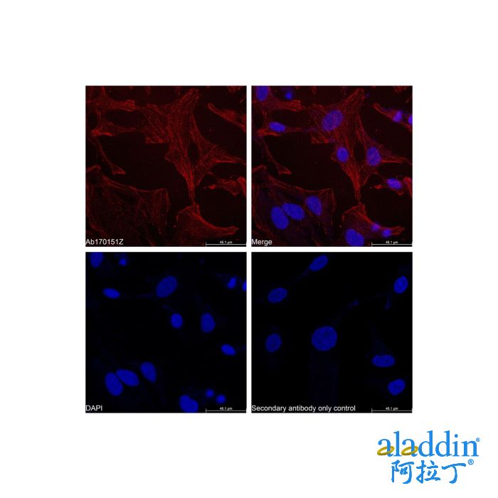 Goat Anti-Rabbit IgG H&L (TRITC)