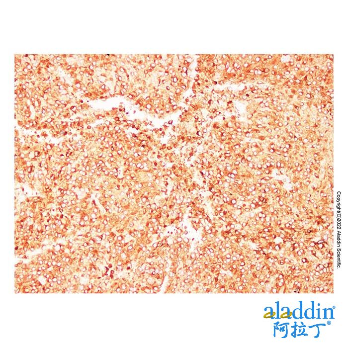 Tyrosinase Mouse mAb