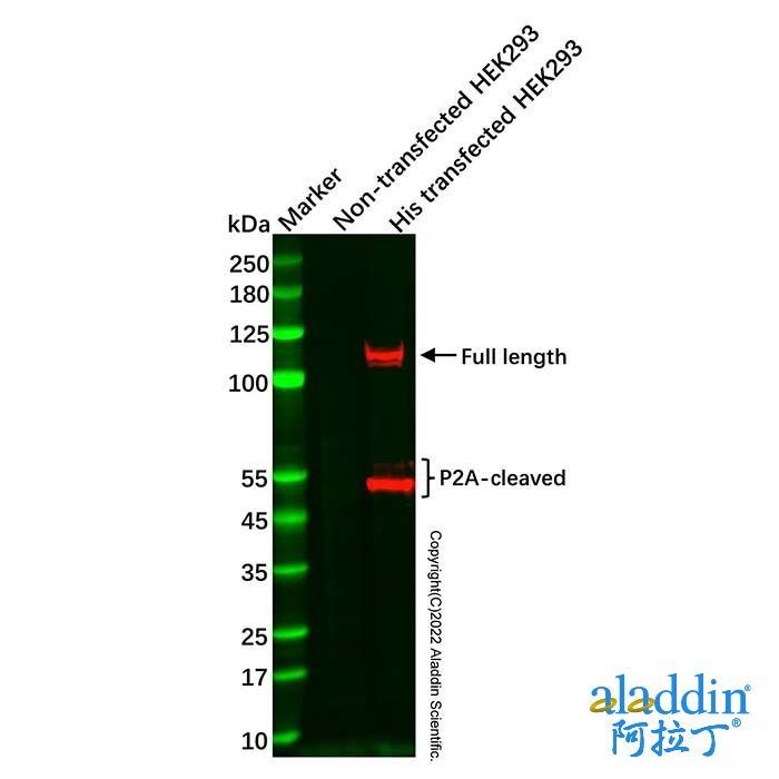 Recombinant His tag Antibody