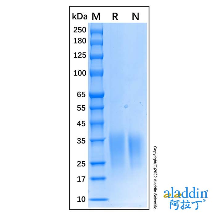 Recombinant Human Activin RIIA Protein