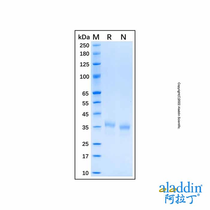 Recombinant Human Cathepsin S Protein