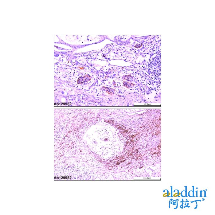 Recombinant Synaptophysin Antibody