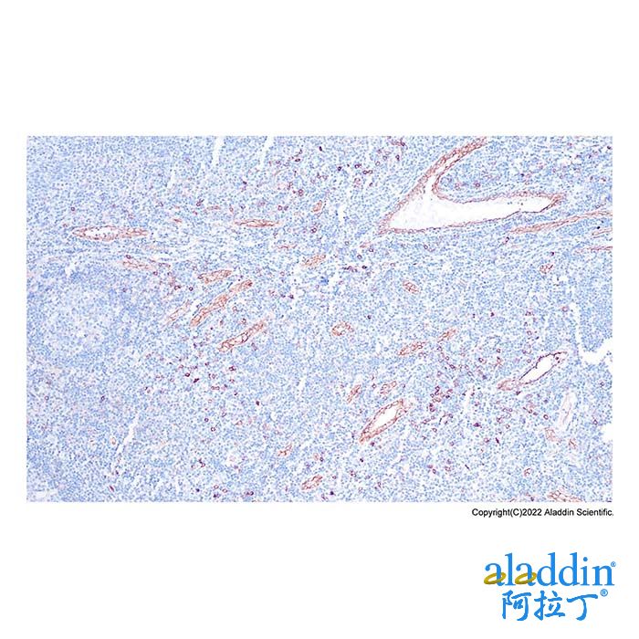 Recombinant IL3RA/CD123 Antibody