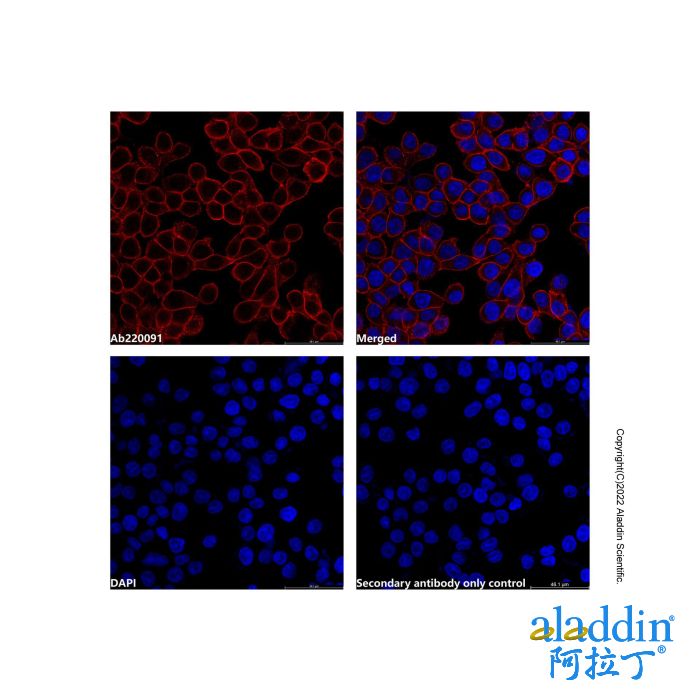 Goat Anti-Human IgG (TRITC) (Ready to use)