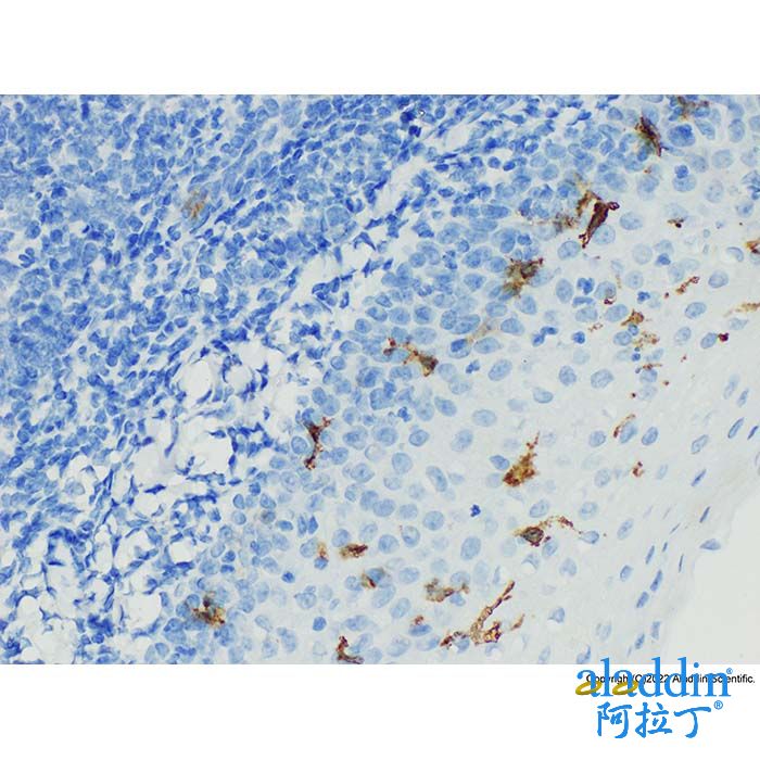 Recombinant CD1a Antibody