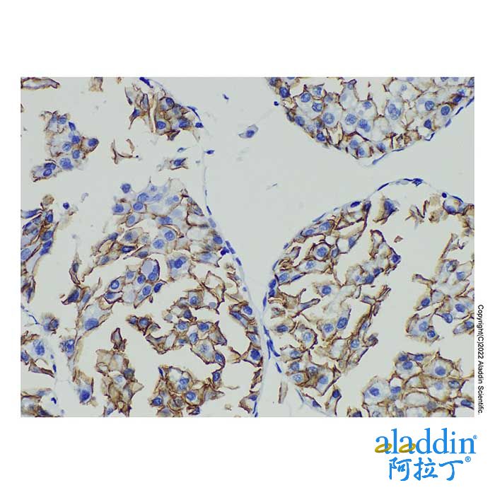 N Cadherin Mouse mAb