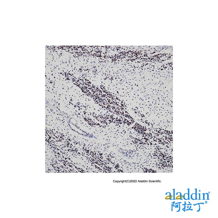 Recombinant MyoD1 Antibody